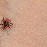 These 11 New Jersey Areas Are Reporting the Highest Tick Risk This Summer